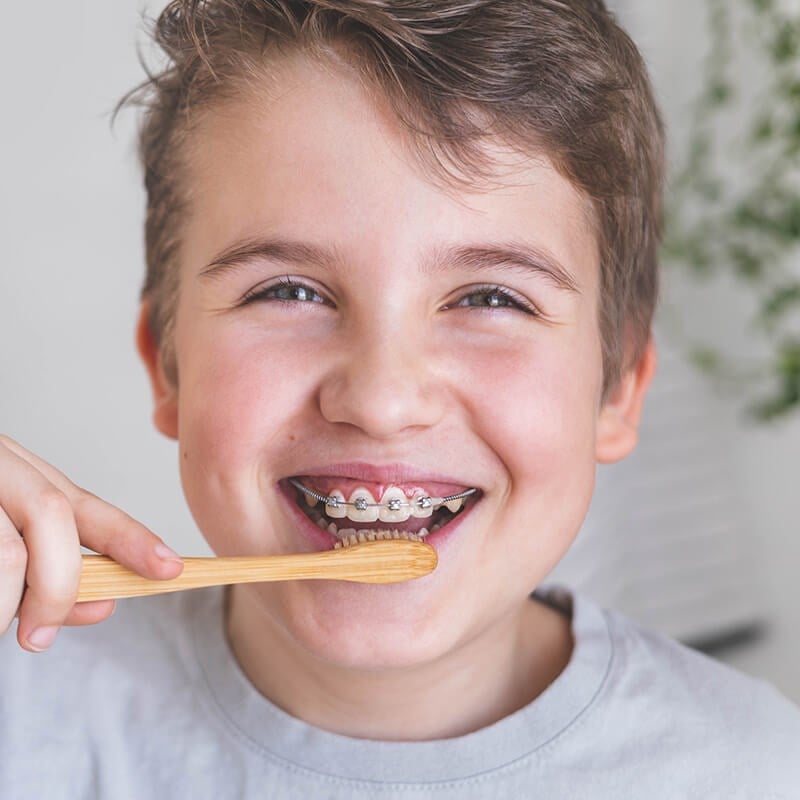 Braces